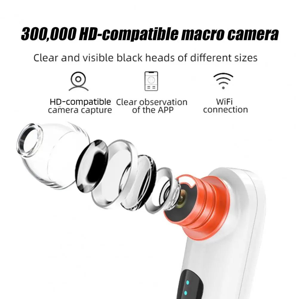 Clear View Pore Vacuum with Camera - Aries x Rose