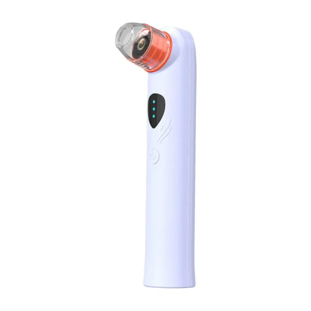 Clear View Pore Vacuum with Camera - Aries x Rose