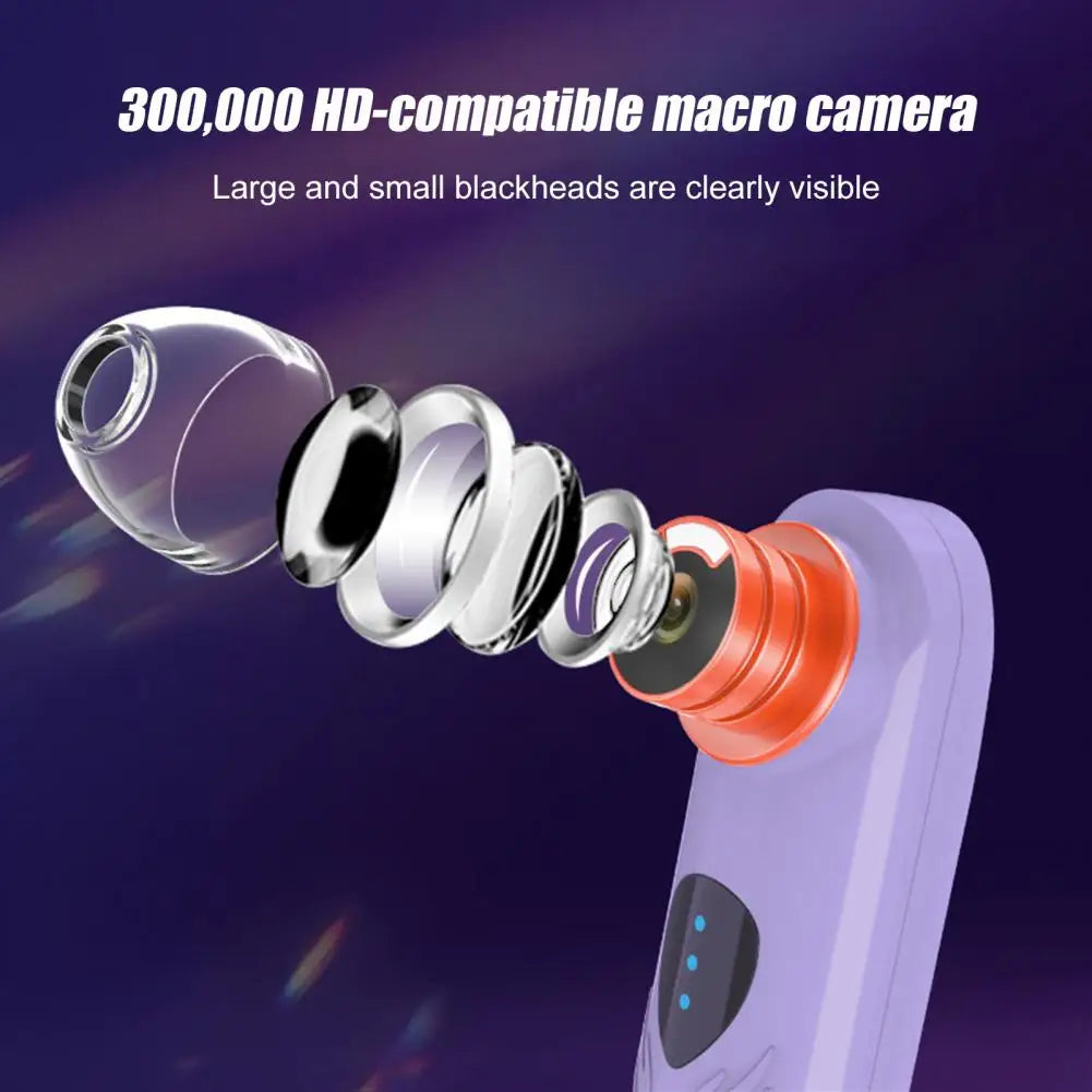 Blackhead Pore Vacuum Extractor Skin Magnifier Blackhead Remover Vacuum with Camera for Acne Removal Usb Rechargeable for Men