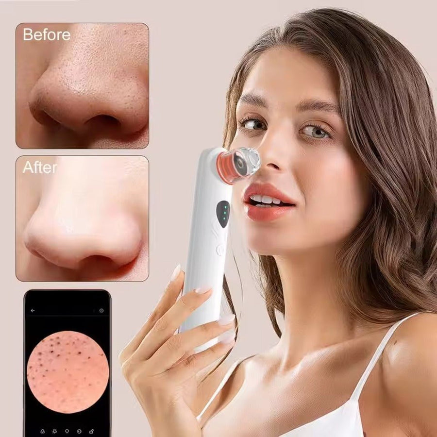 Clear View Pore Vacuum with Camera - Aries x Rose