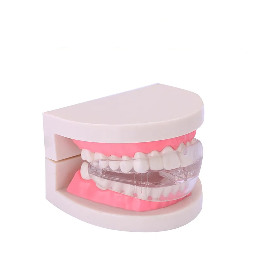 SilentEase Anti-Snoring Mouth Guard