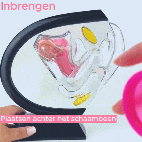 Femnix Menstrual Disc